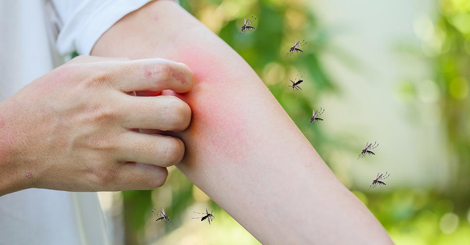 Tem alergia a picadas de inseto? Veja como evitar problemas!